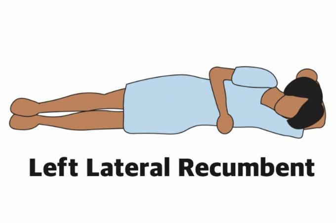 Recumbente lateral izquierdo