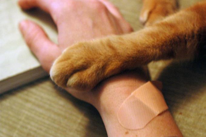 Una mano humana vendada y una pata de gato.